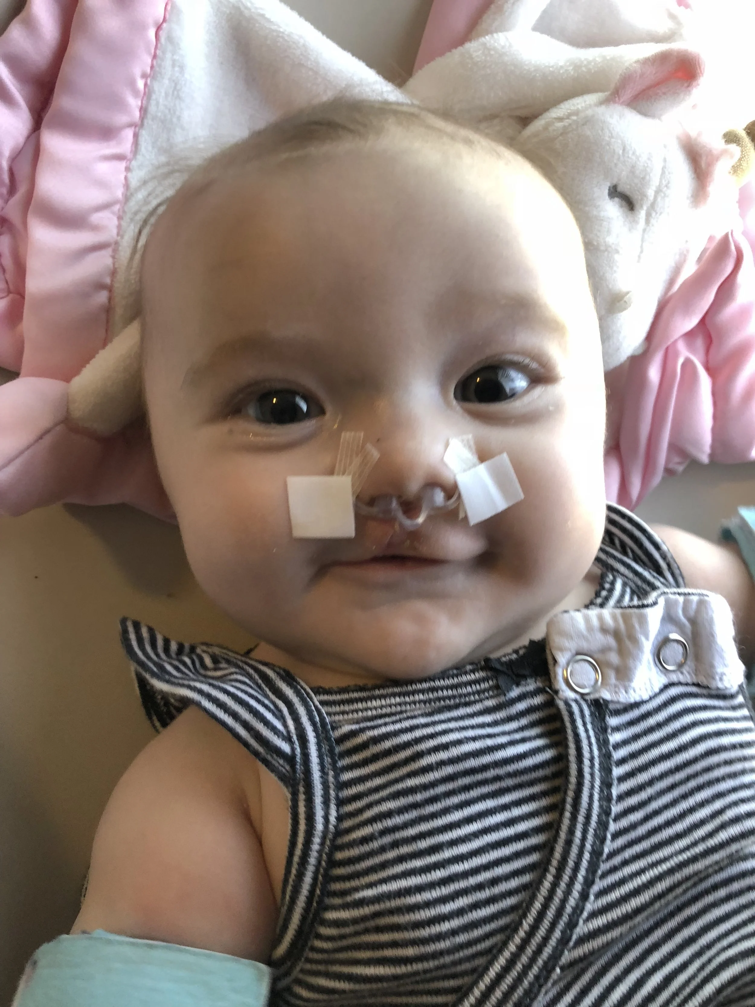 Close-up of a baby with a nasal tube and adhesive tape, lying on a pink blanket with a stuffed animal in the background, wearing a striped sleeveless outfit.