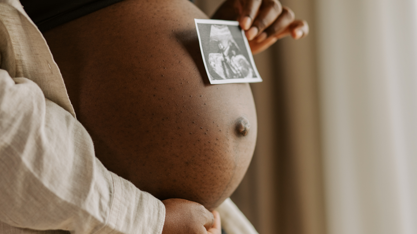 A pregnant woman holding an ultrasound picture on her belly.