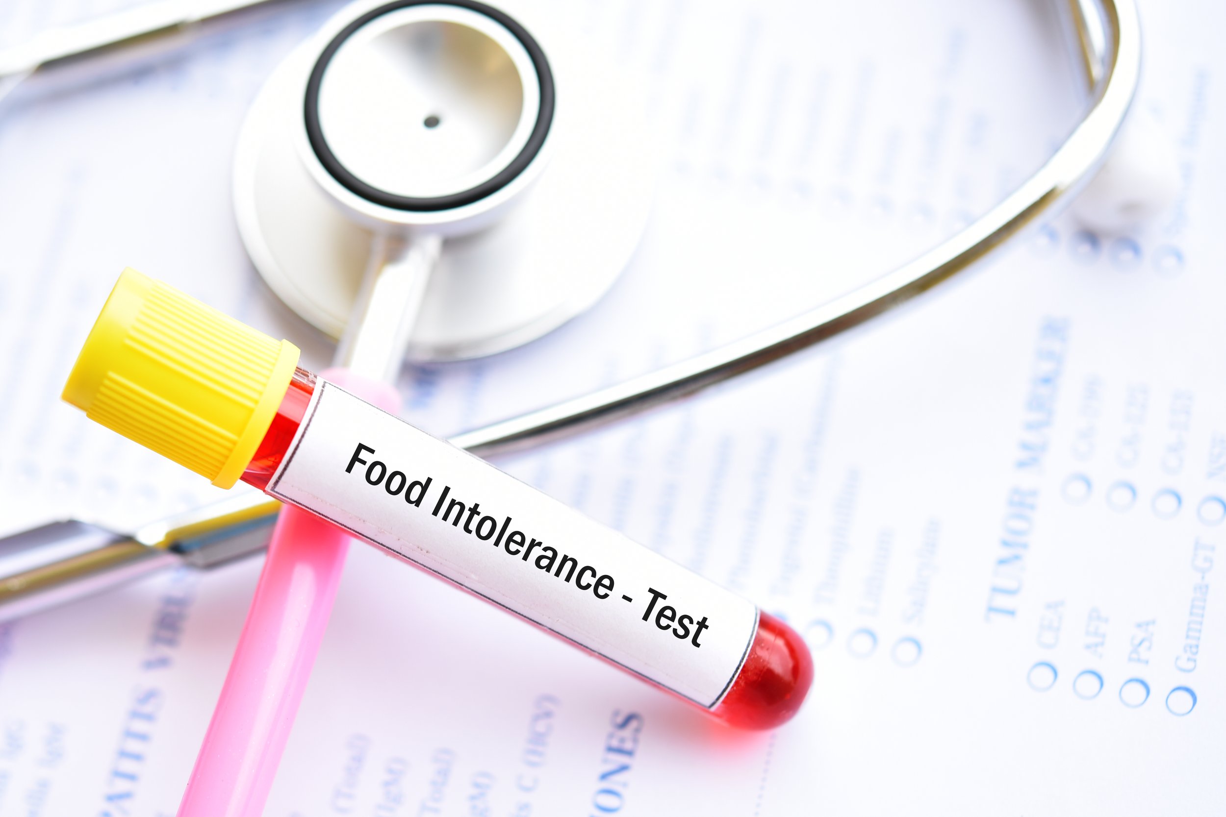 Food Intolerance Testing: Are IgG Tests a Waste of Money?