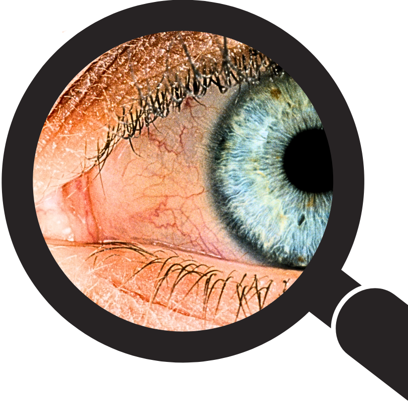 Close-up of a human eye as seen through a magnifying glass, showing detailed iris and blood vessels.