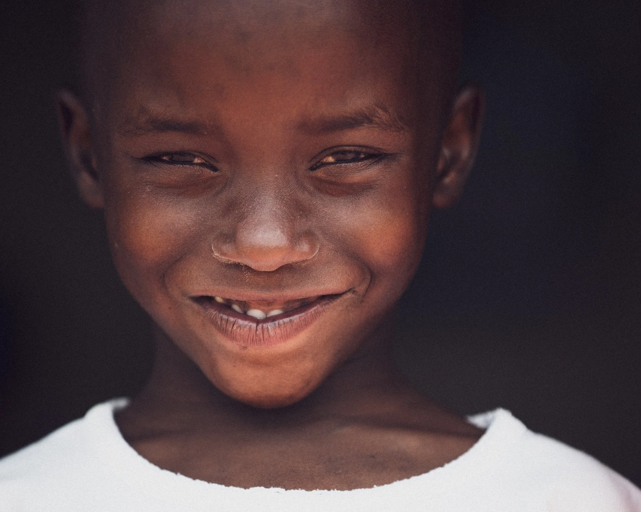Close-up of a smiling young boy with dark skin, showing missing and crooked teeth, wearing a white shirt, against a dark background.