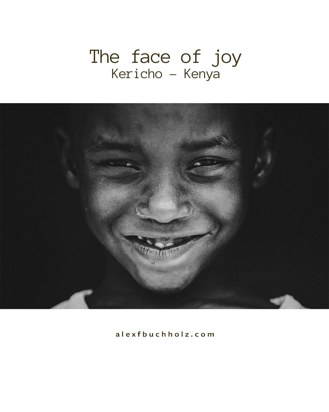Black and white close-up portrait of a smiling child with a joyful expression, some teeth missing.