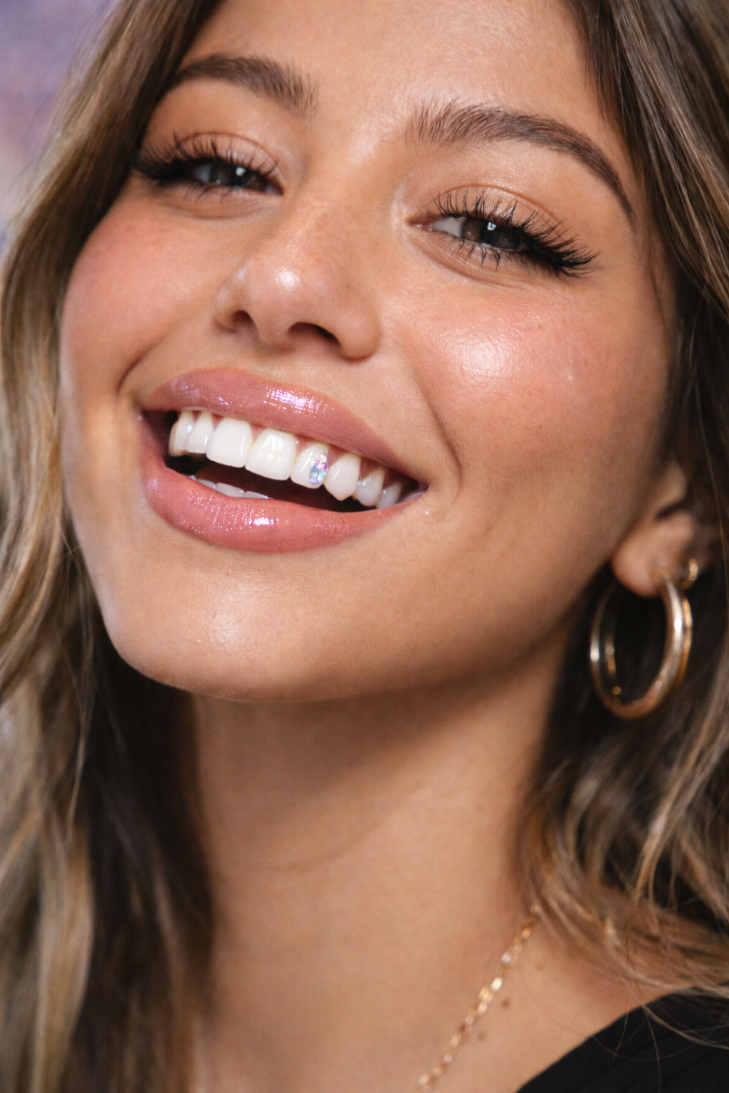 Tooth Gems: Sparkle Safely with a Dentist-Approved Approach ✨