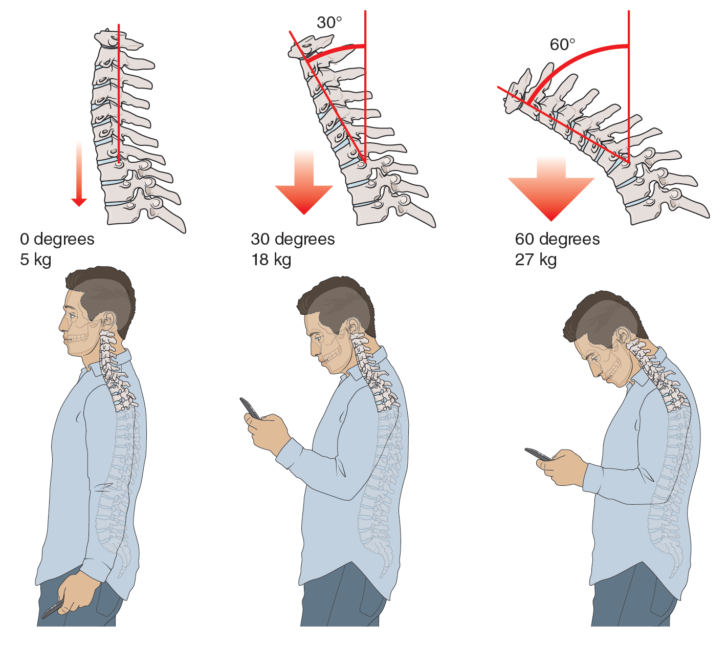 med phone neck.png