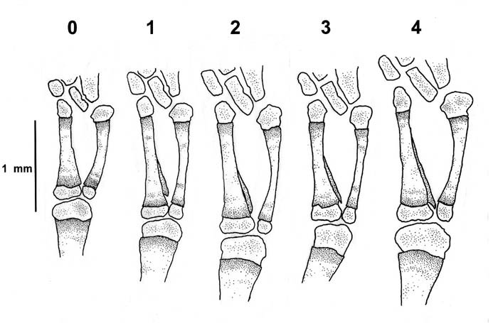 3-Tibial Spurs.jpg
