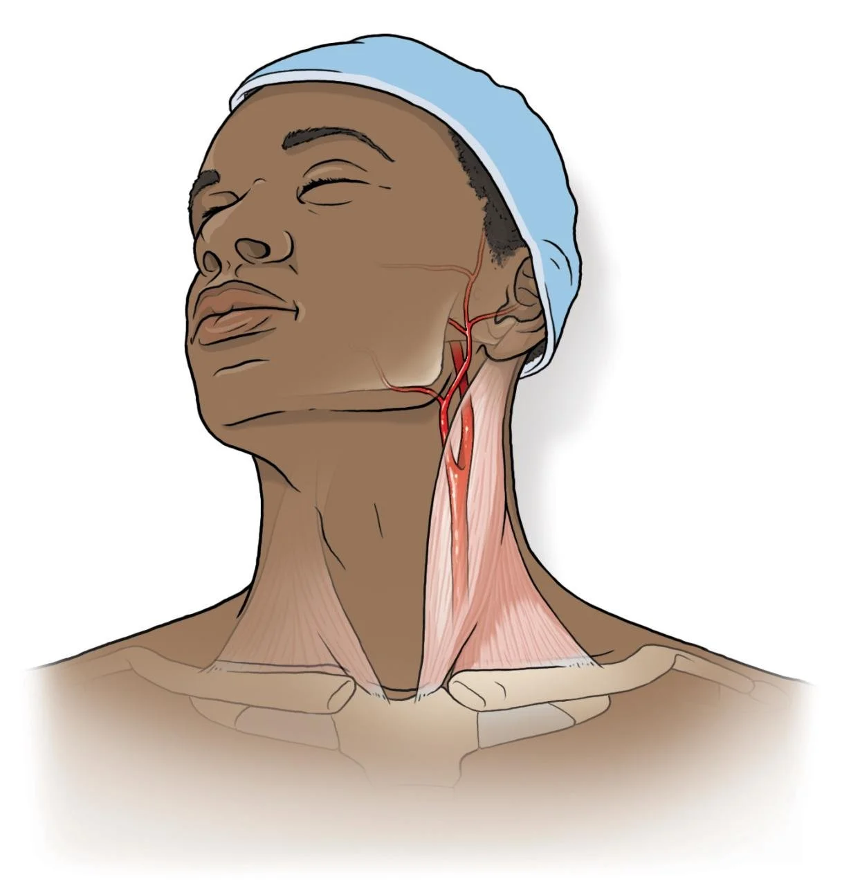 Med coronary artery.jpg