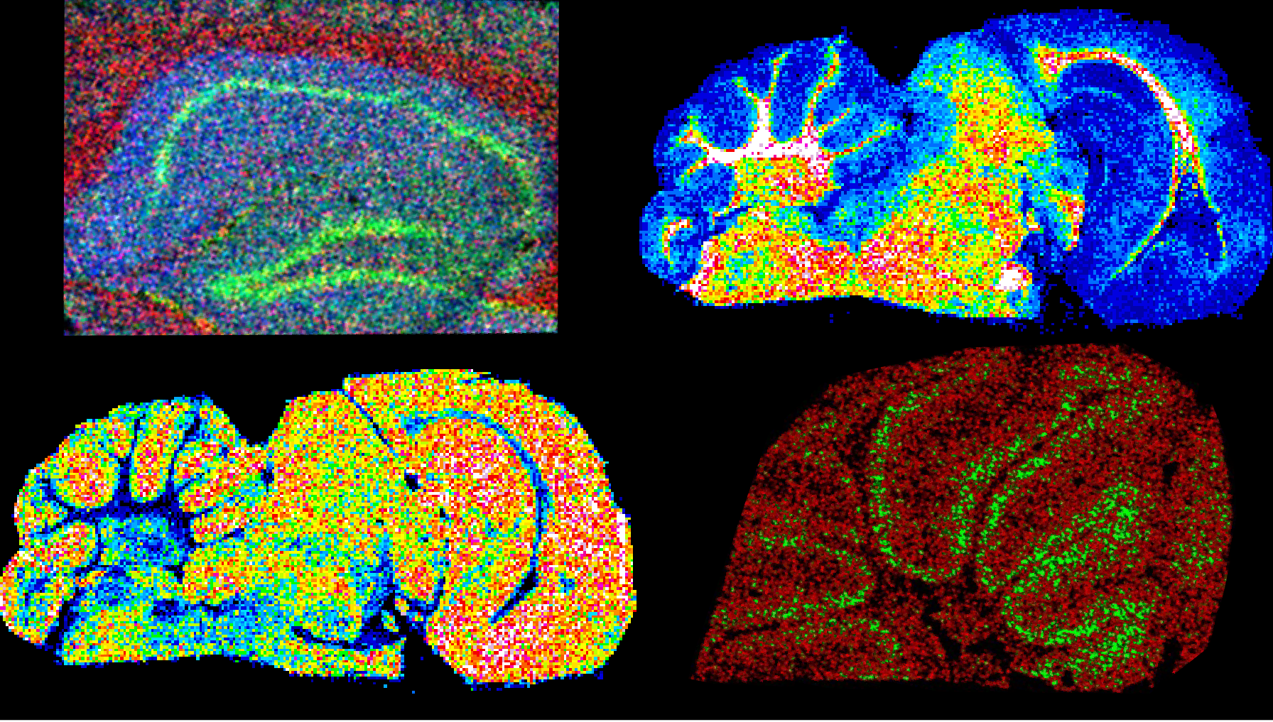 Colorful cross-sectional brain imaging scans generated using MALDI tissue imaging different mass spectrometry imaging and color-mapping techniques.