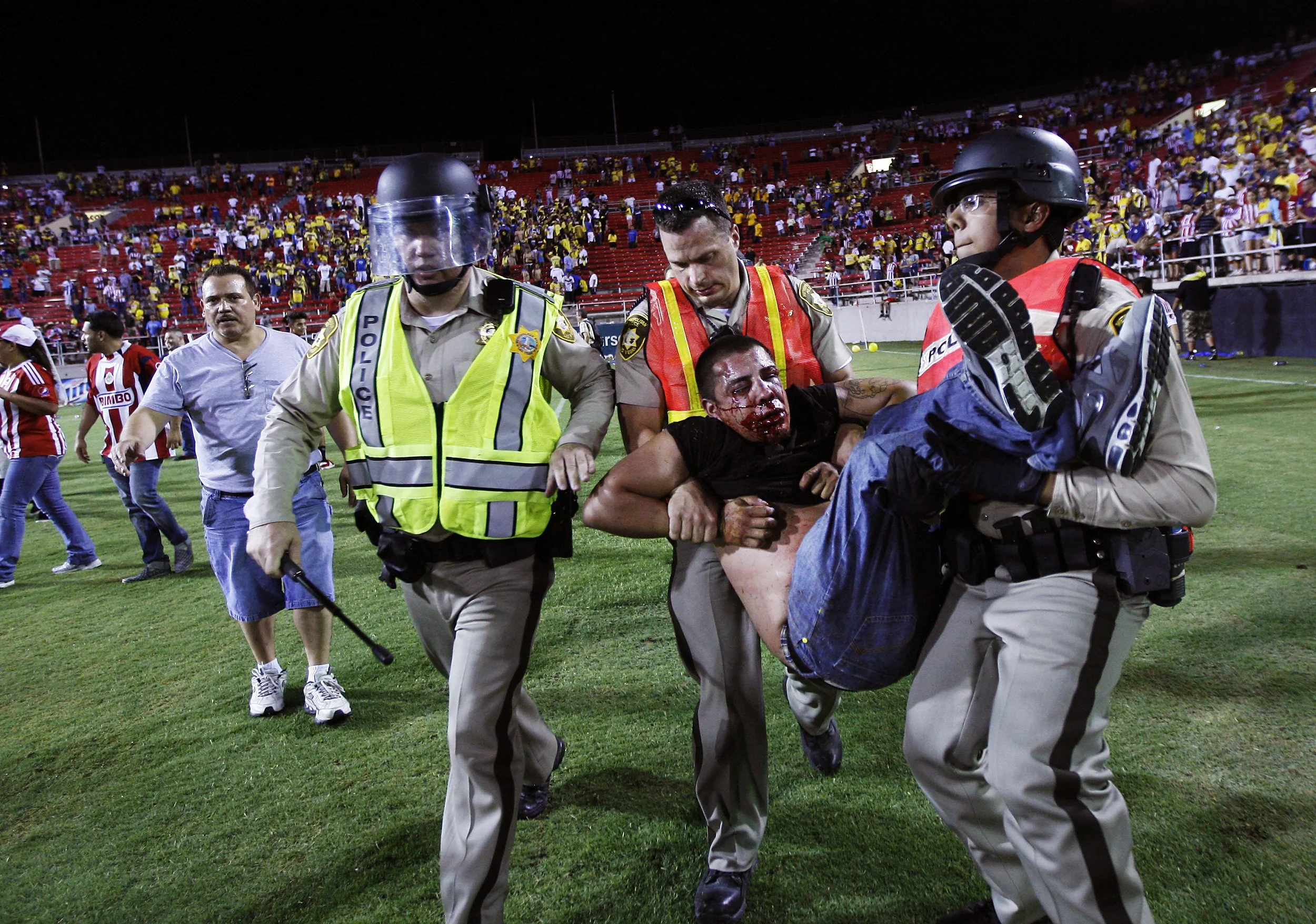 A bloody and beaten fan gets carried out of Sam Boyd Stadium after the Chivas vs. Club America game in Las Vegas on July 3, 2013.