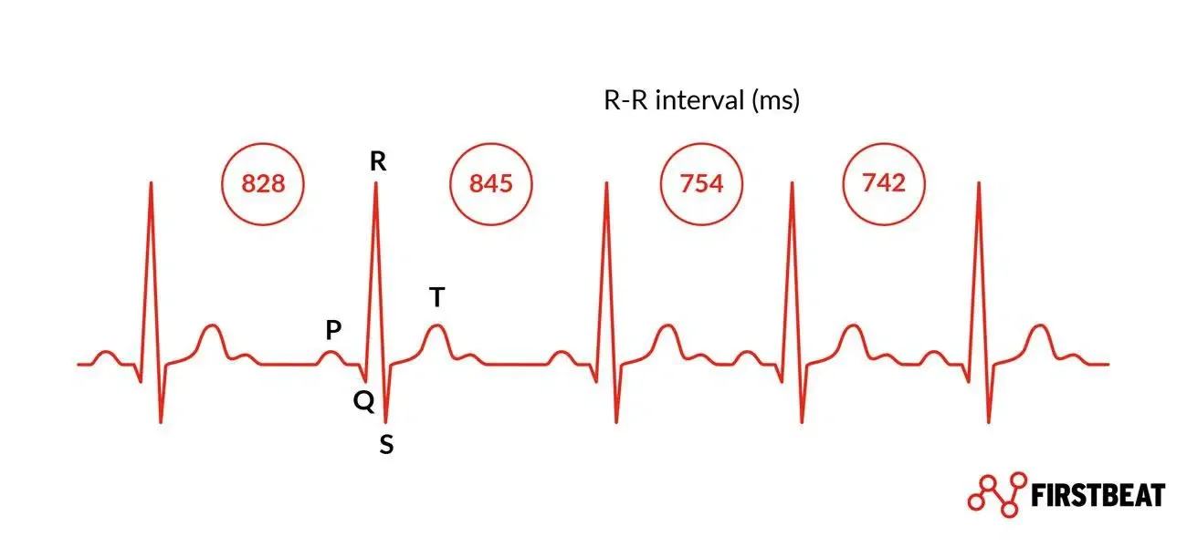 Heart rate variability chart showing the time between heartbeats