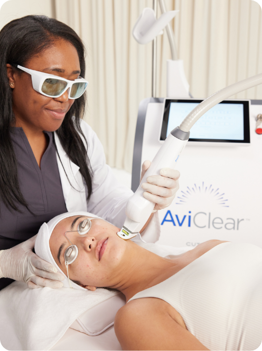 AviClear laser treatment