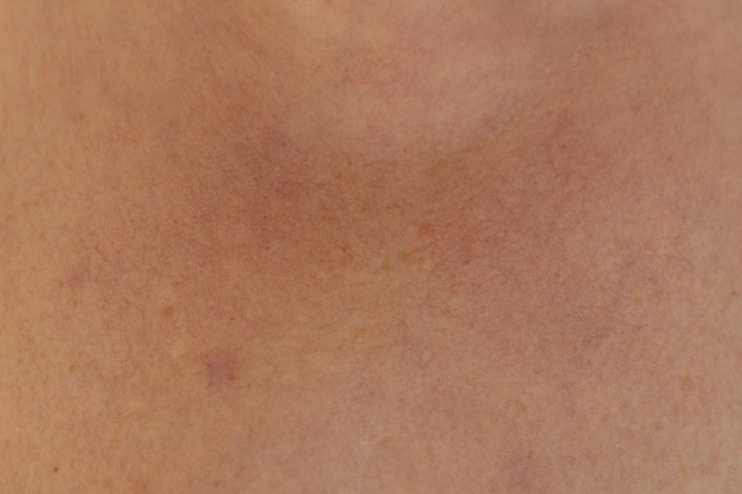 Skin texture