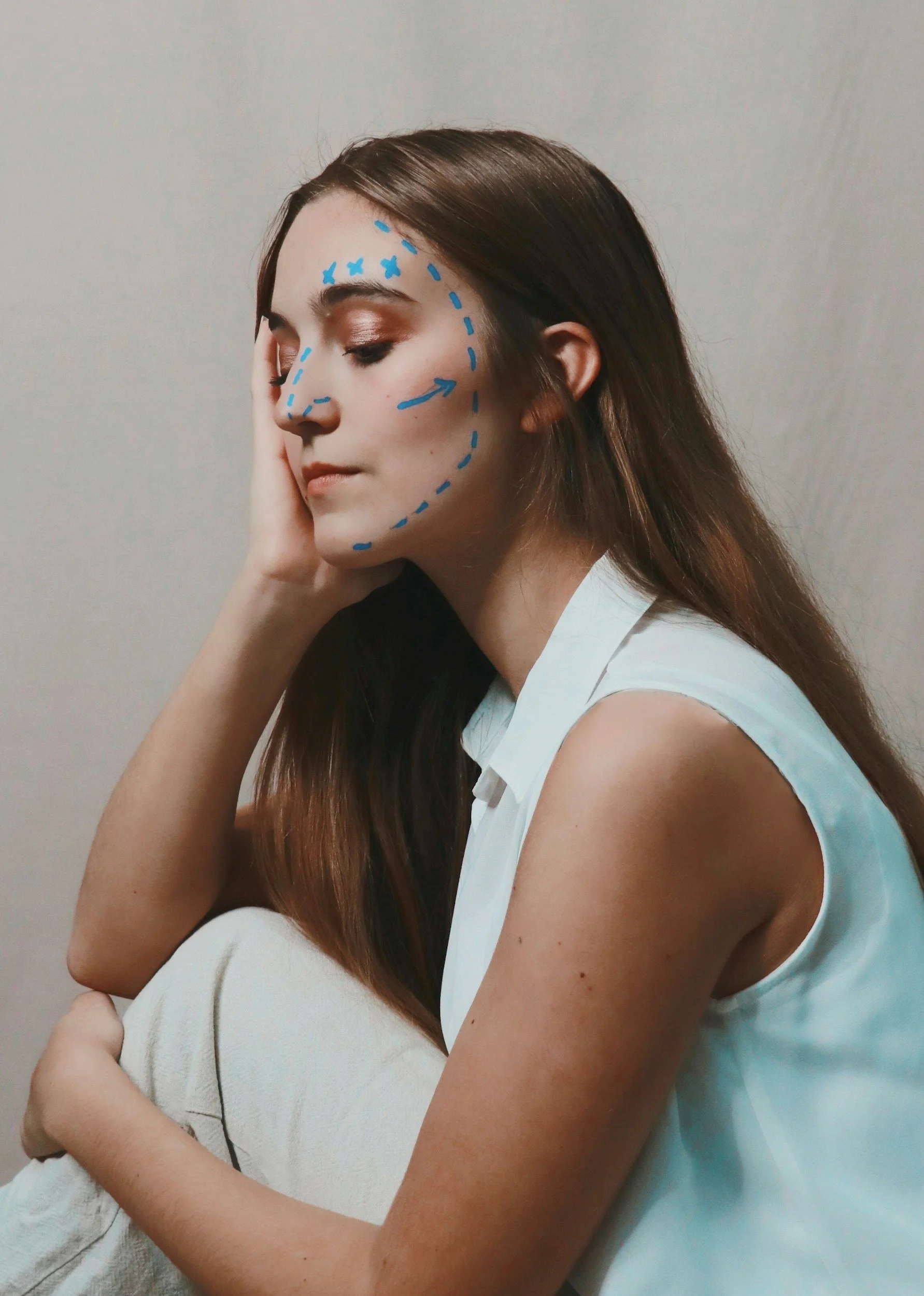 Woman with preoperative surgical lines drawn on her face
