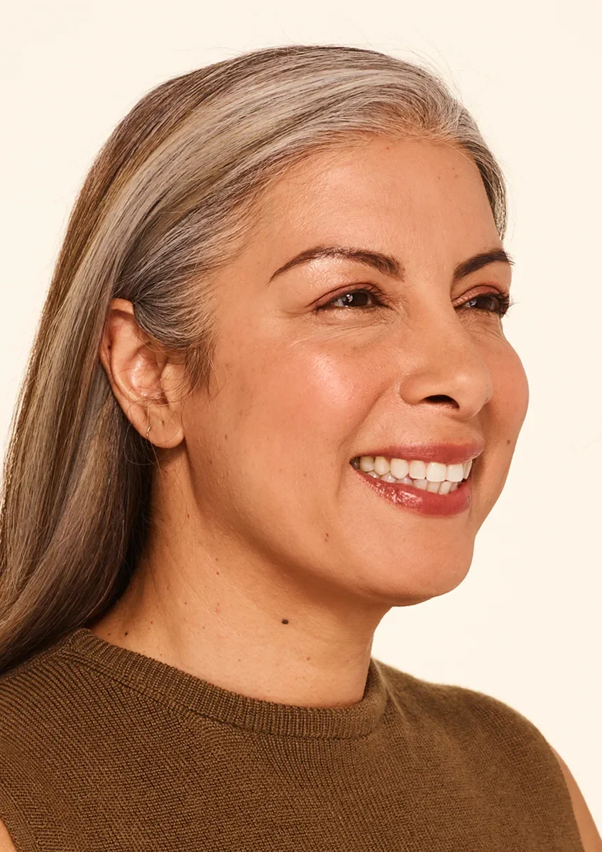 After botox