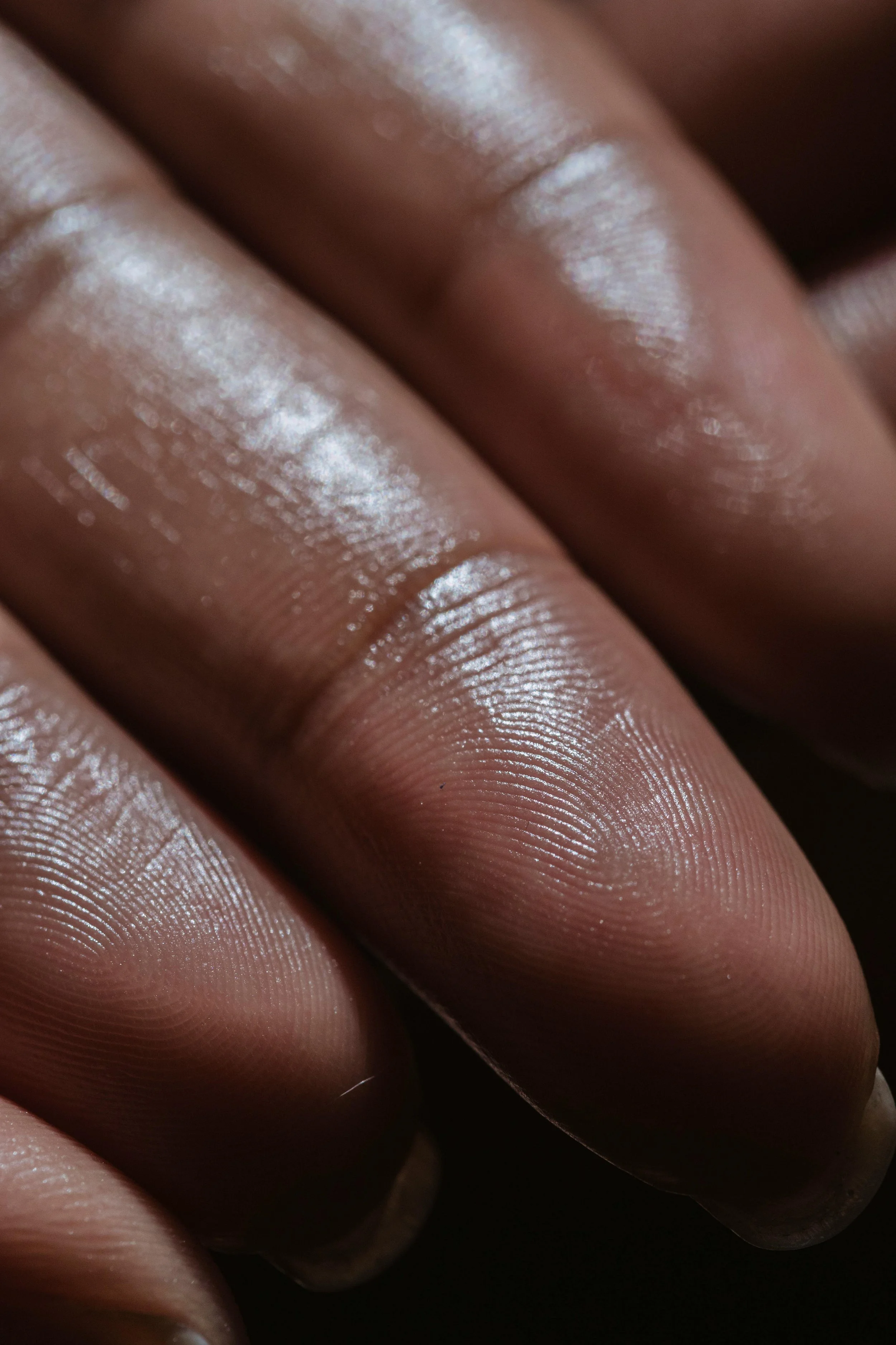 Sweaty hands