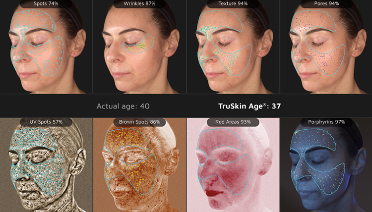 Visia facial scan breakdown, showing the different layers of skin being analyzed