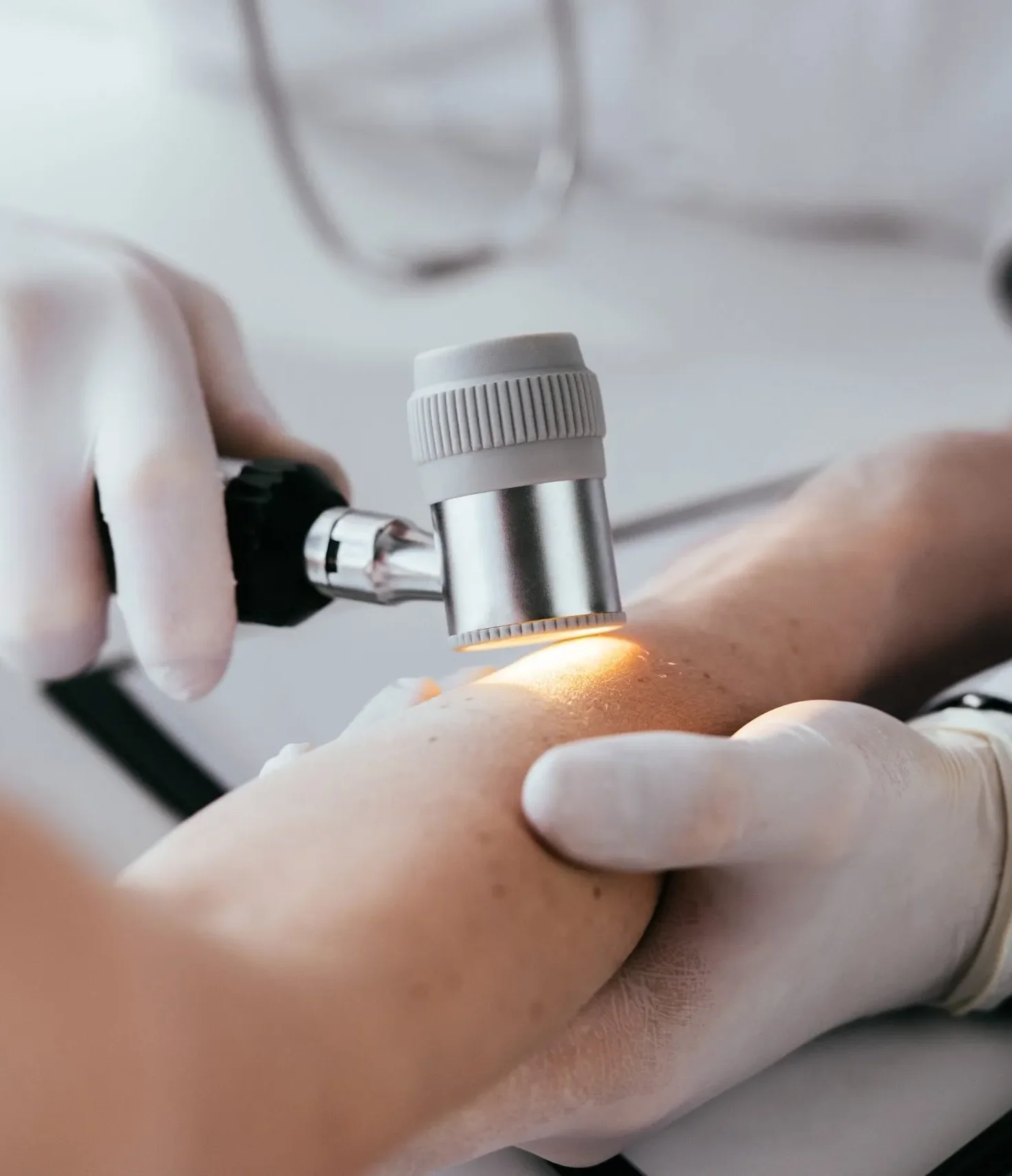 Skin cancer screenings and treatment