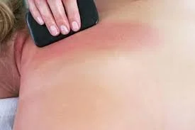 Gua Sha Add on  $25