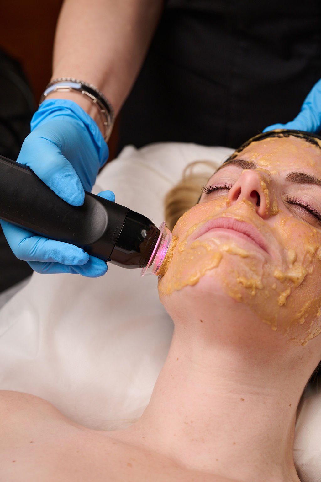 Glo2Facial with Ultrasound Infusion