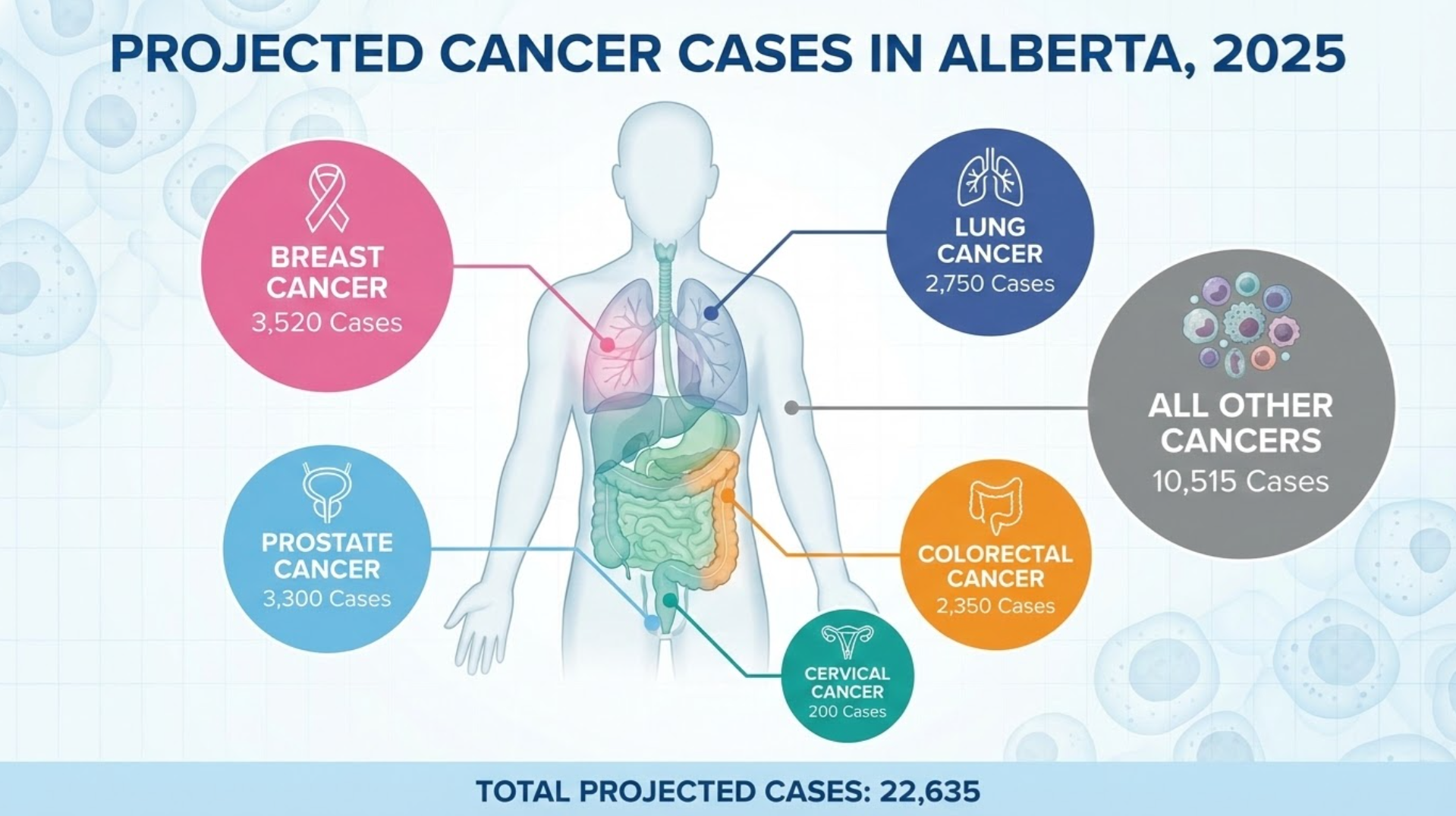 Infographic showing projected cancer cases in Alberta in 2025, including breast, prostate, cervical, lung, colorectal, and other cancers, with total cases of 22,635.
