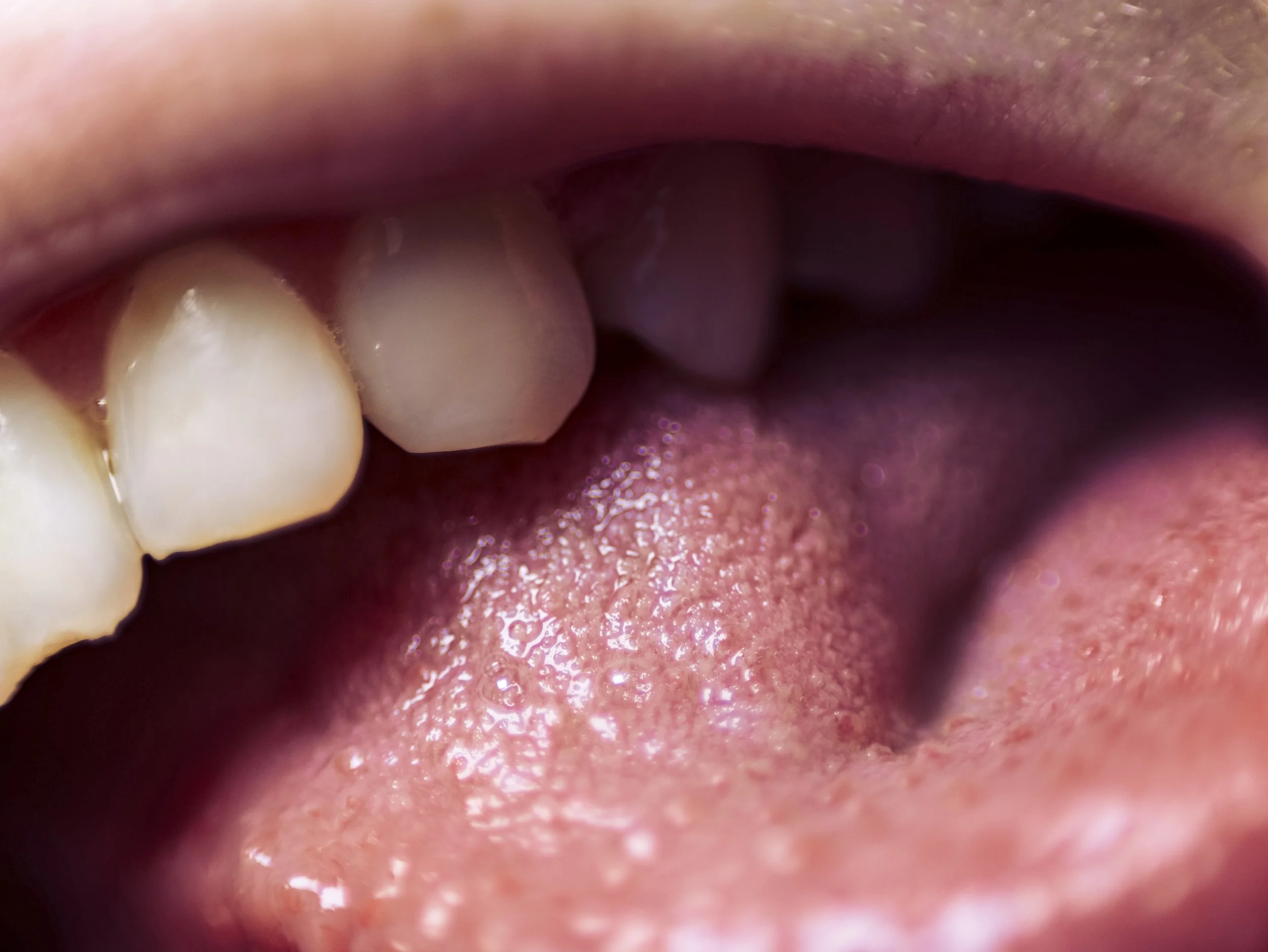 The Weight of Softness