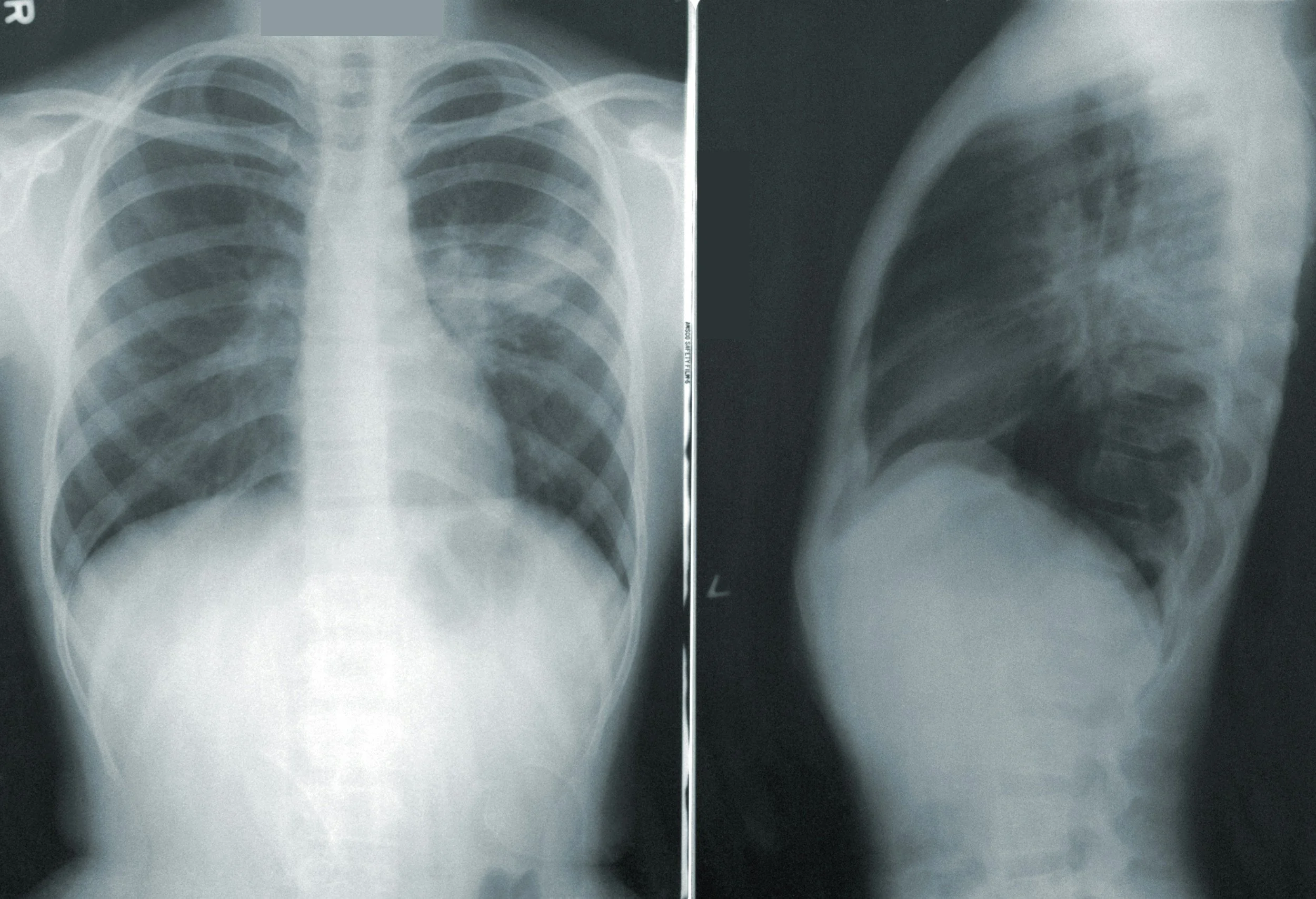 Why Imaging Is Helpful Sometimes… But Often Does Not Change the Outcome 📸🧠