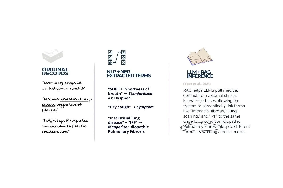 A diagram displaying the process of medical data extraction and inference in pulmonary fibrosis. It shows three columns: the first with original medical records, the second with extracted terminal terms like 'SOB' and 'Dyspnea', and the third with inference explaining how RAG helps language models link clinical terms to the same underlying condition, despite different formats and wording.