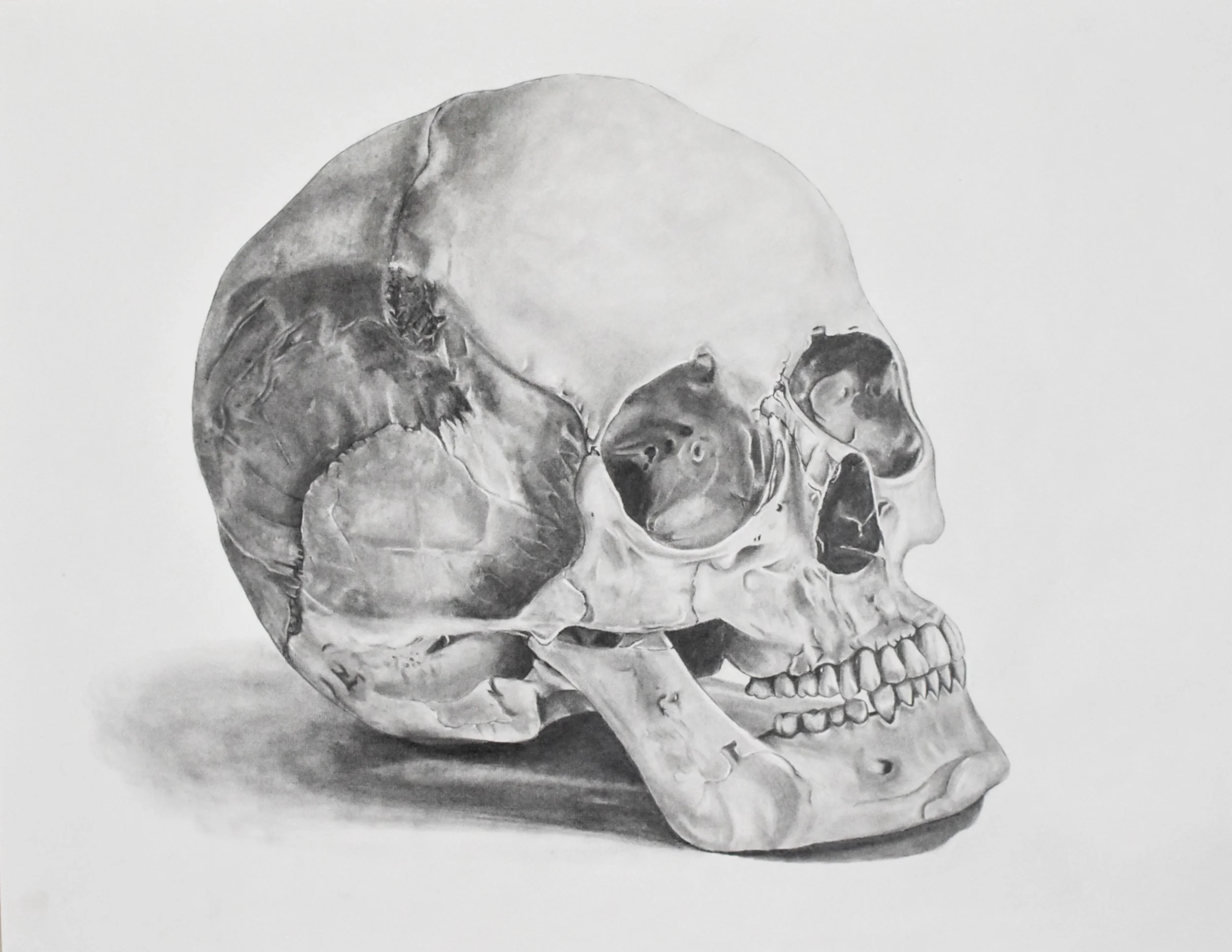 Black and white detailed illustration of a human skull viewed from the left side.
