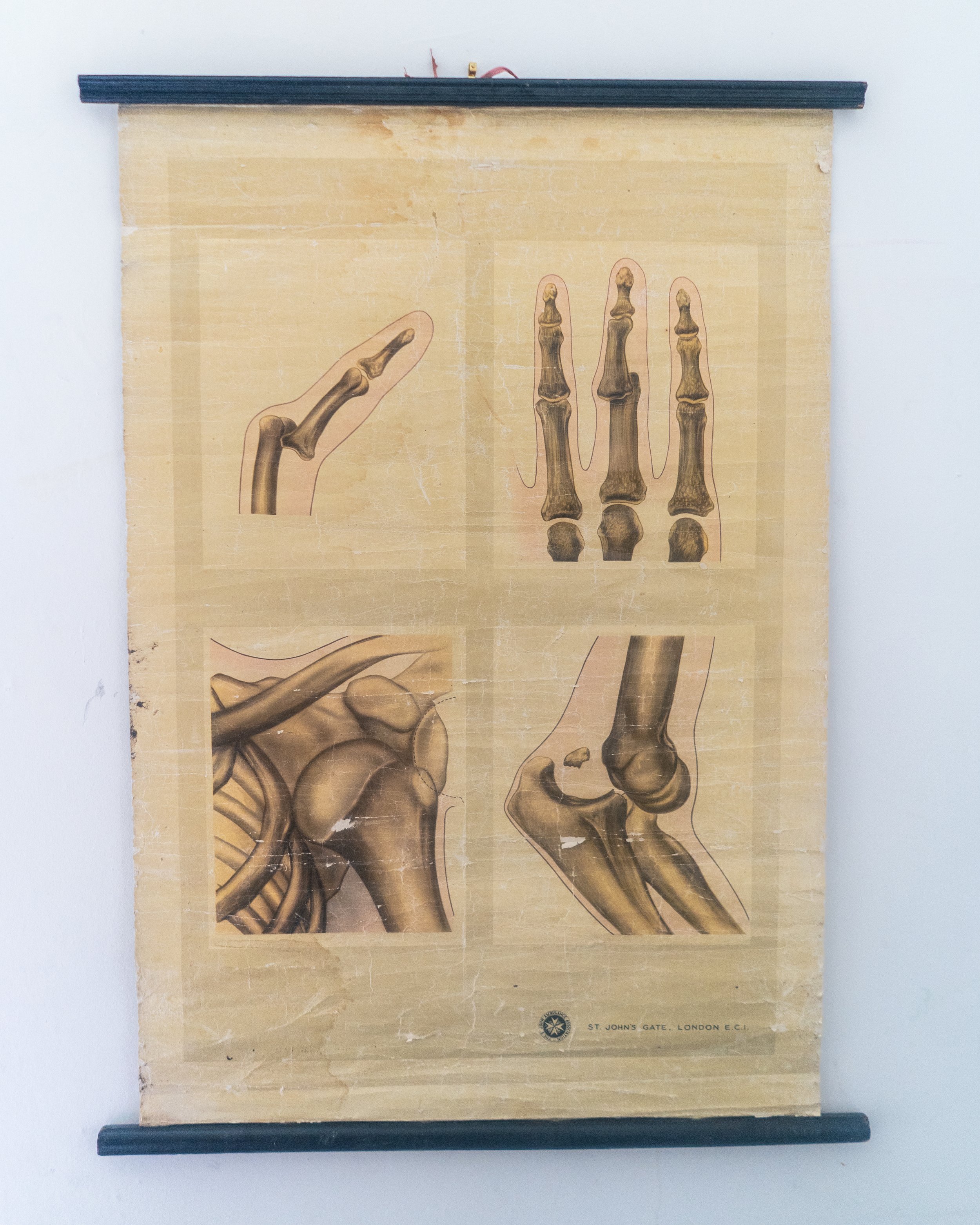 St Johns Ambulance Medium Poster Bone Collection