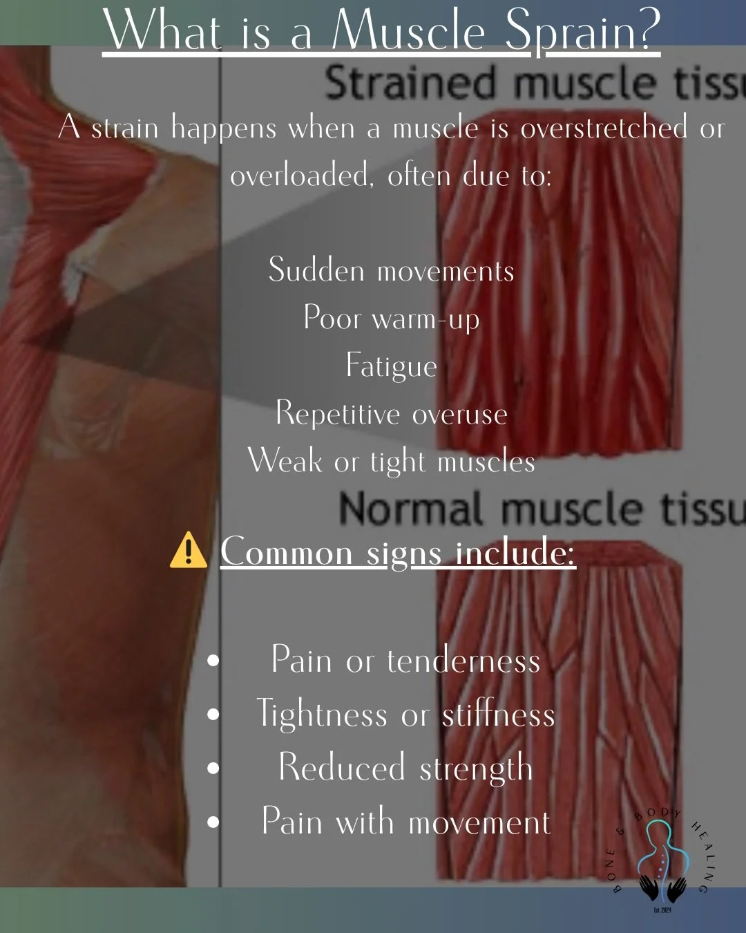 Not all muscle strains are equal 👀
Knowing the grade helps guide the right treatment and recovery timeline 💪  Message me to book in or use the link in my bio 🔗#longeaton #musclesprain