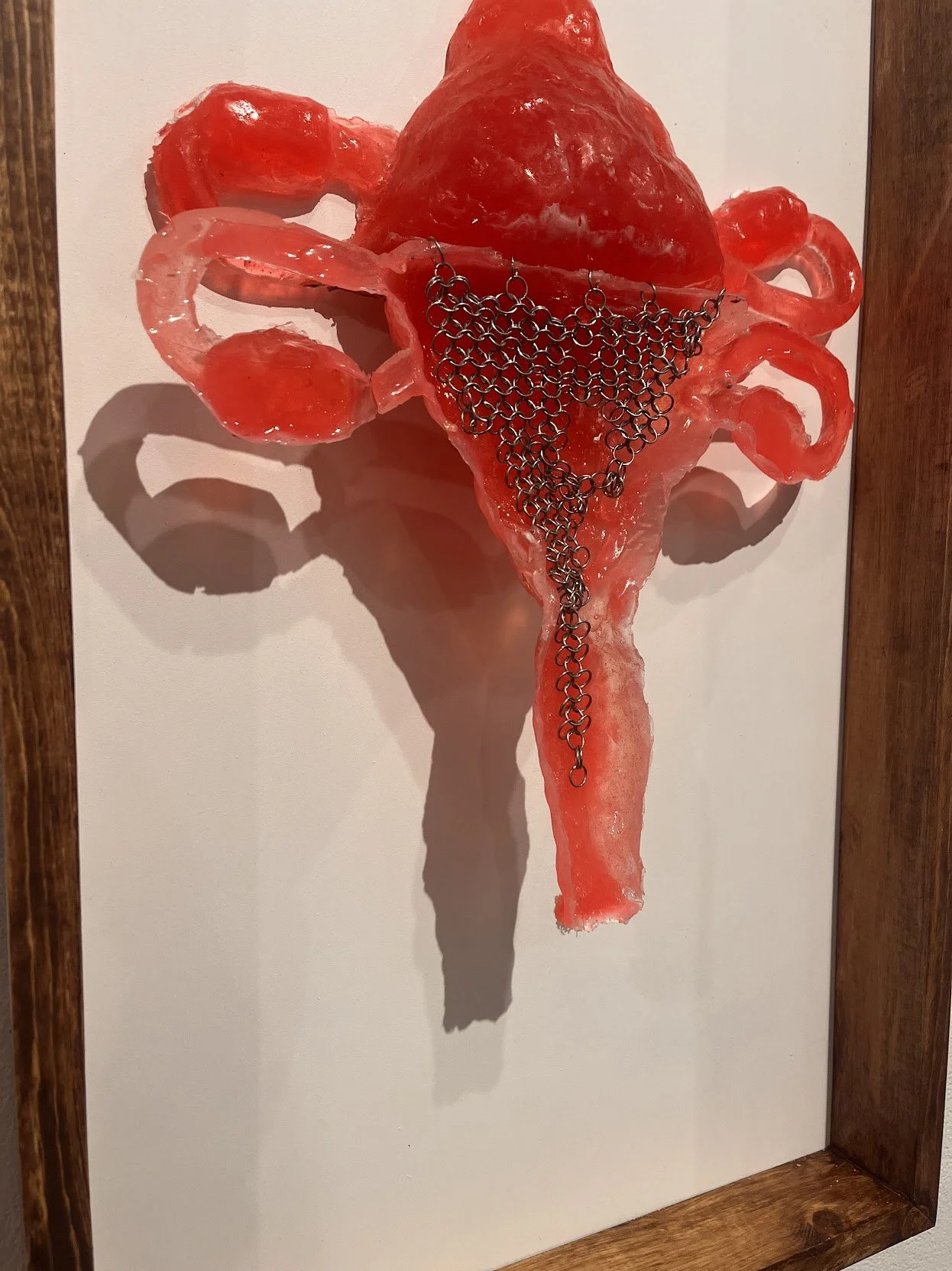Uterus2.jpg