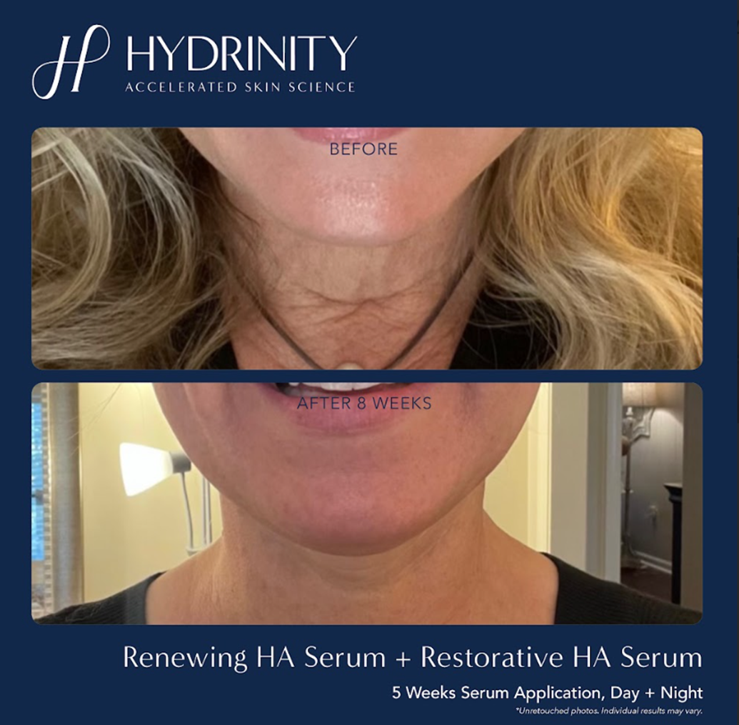 hydrintiy BA renewing + restore serum.png