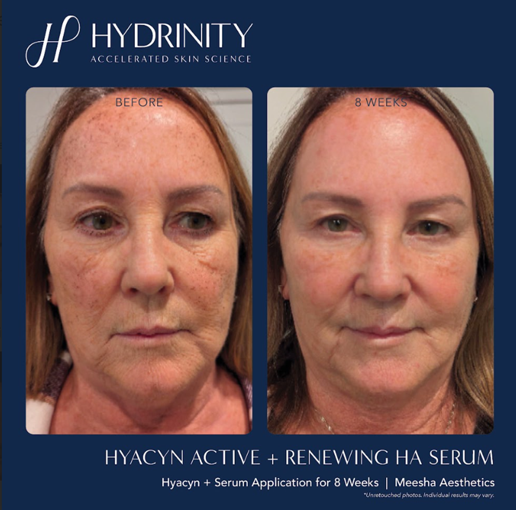 hydrinity BA mist + renewing serum.png