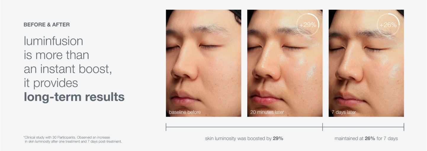 Luminfusion, aging skin, uneven skin, luminosity
