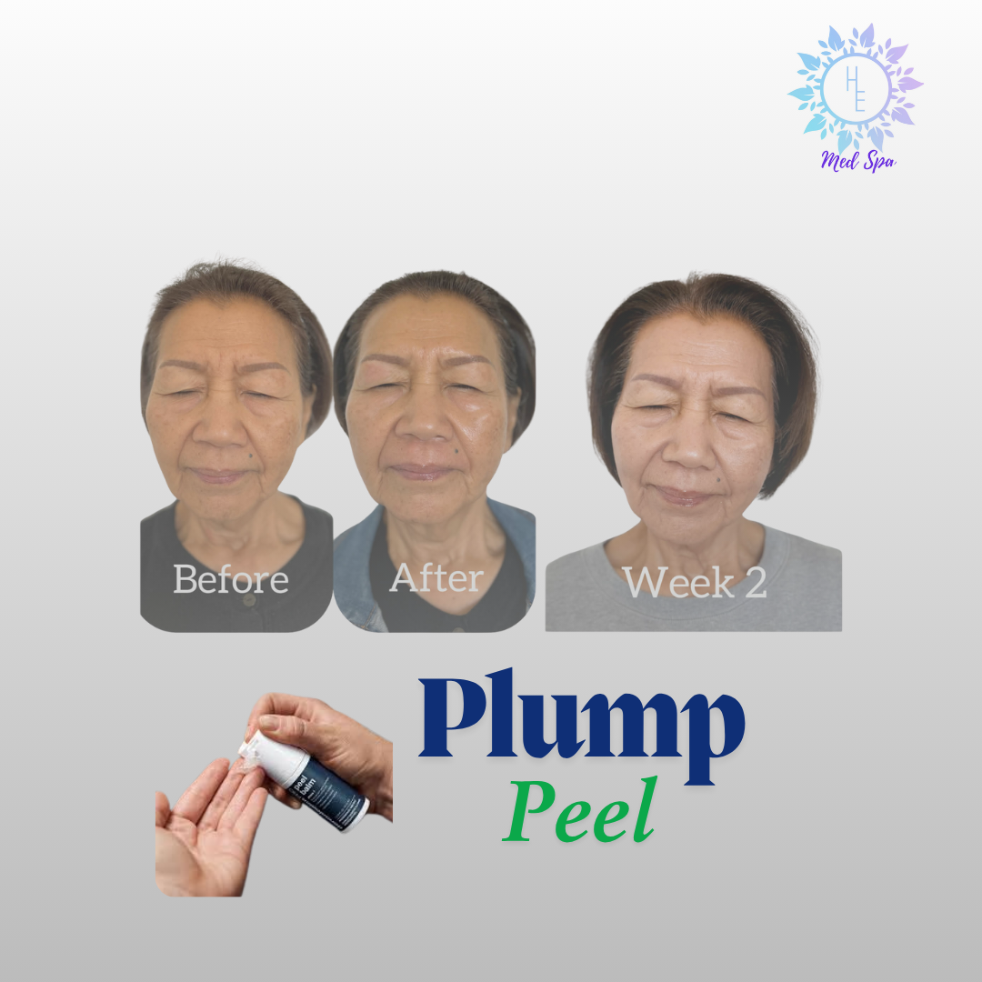 plump peel, plump peel near me, plump peel tulsa, plump peel broken arrow, dermalogica plump peel tulsa