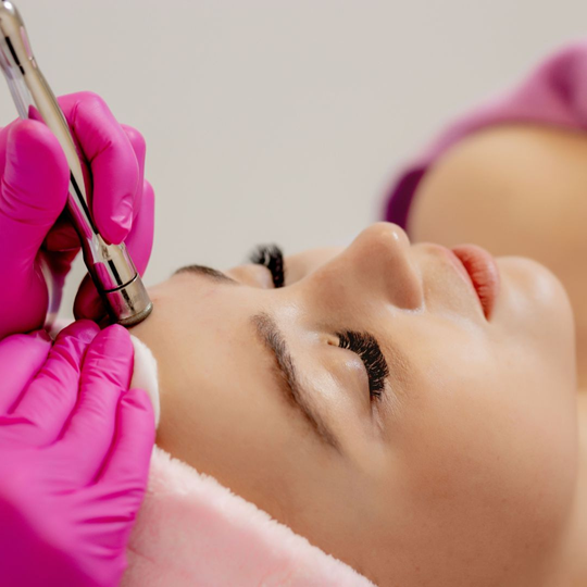 microdermabrasion, exfoliation, uneven texture