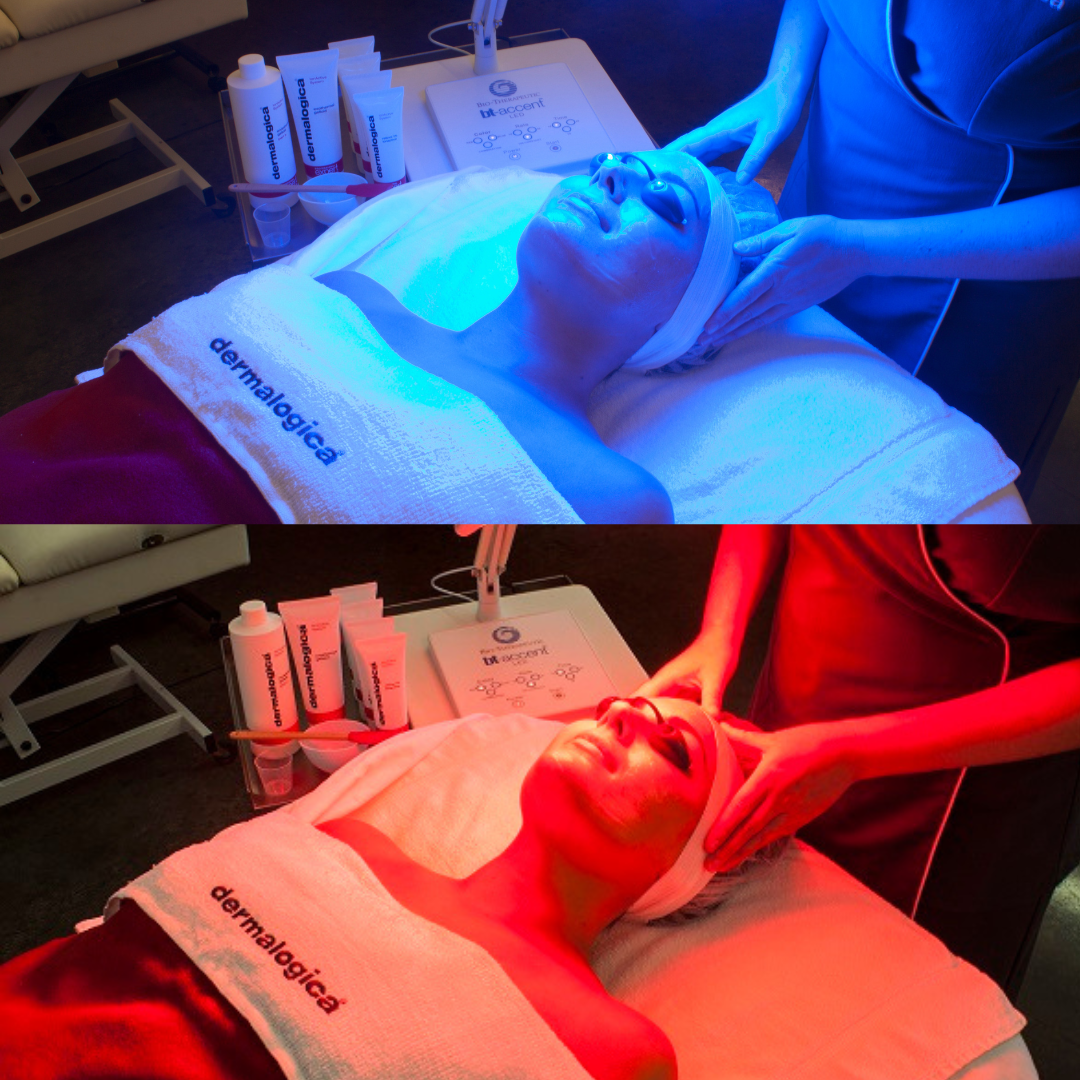 light therapy, acne, hyperpigmentation, lines, wrinkles
