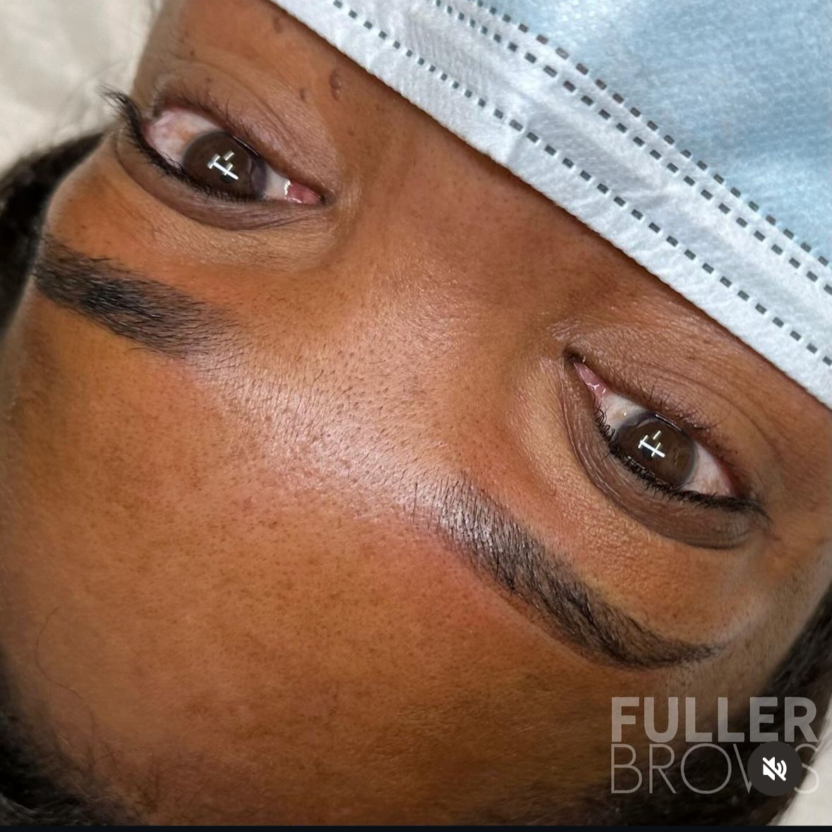 Close-up of a person's face with a focus on their eyes and eyebrows, wearing a surgical cap, showing clear skin and well-groomed eyebrows.