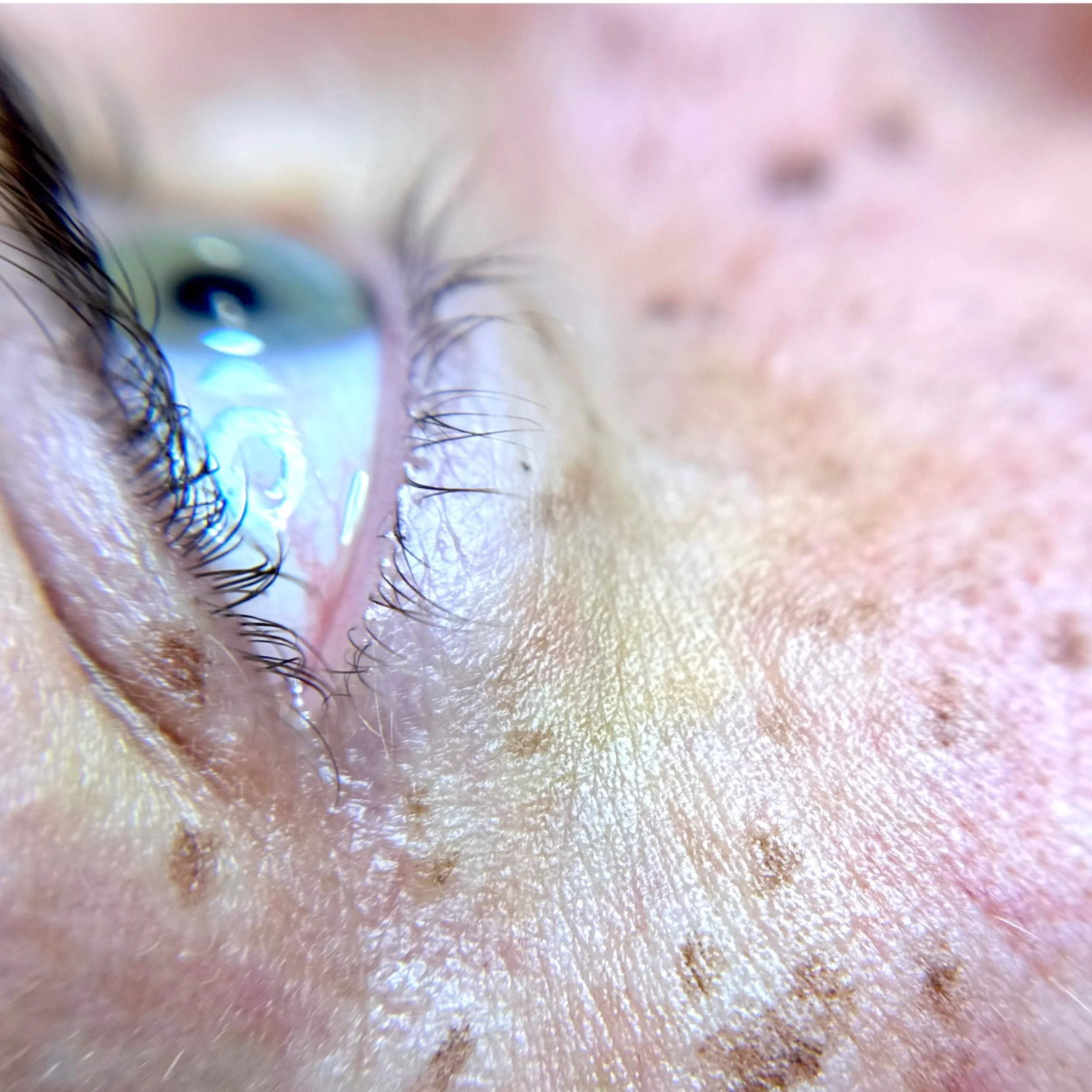 Close-up of a human eye with detailed eyelashes, iris, and surrounding skin showing skin texture and freckles.