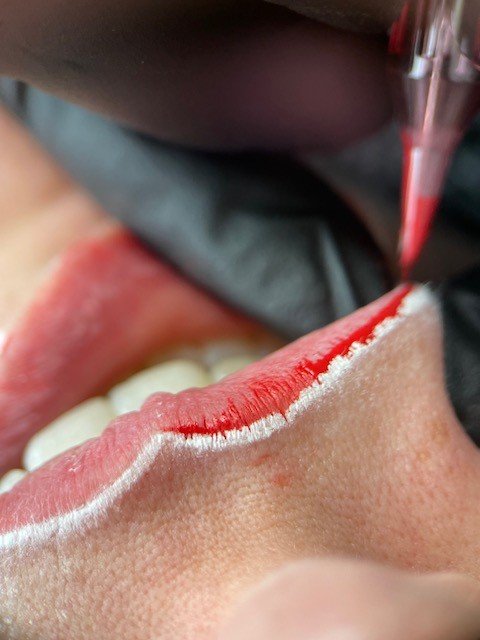 Close-up of a person receiving a lip tattoo or permanent lip makeup procedure.