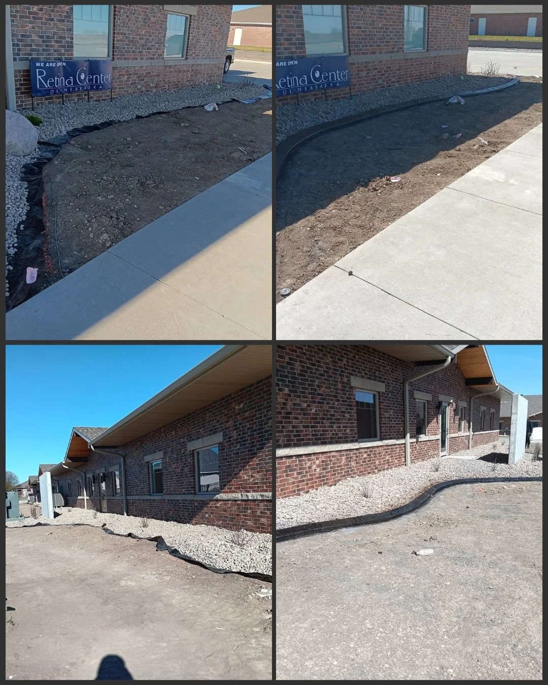 before and after retina.jpg