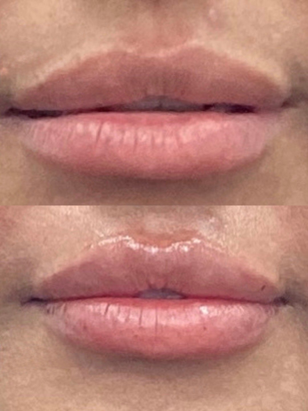 Copy of Before and Afters (NEW Portrait Size).jpeg