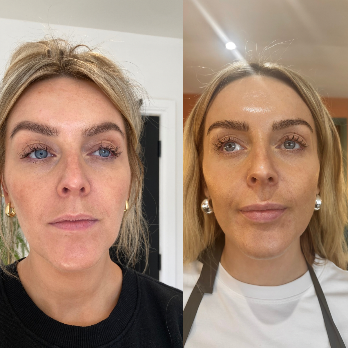 Side-by-side photos of a woman with blonde hair, wearing earrings, before and after a beauty treatment or skincare processing. In the first image, her hair is slightly messy, and she wears a black shirt. In the second, her hair appears neater, and she has a shiny forehead with a slight smile, wearing a white shirt with a black strap and silver earrings.