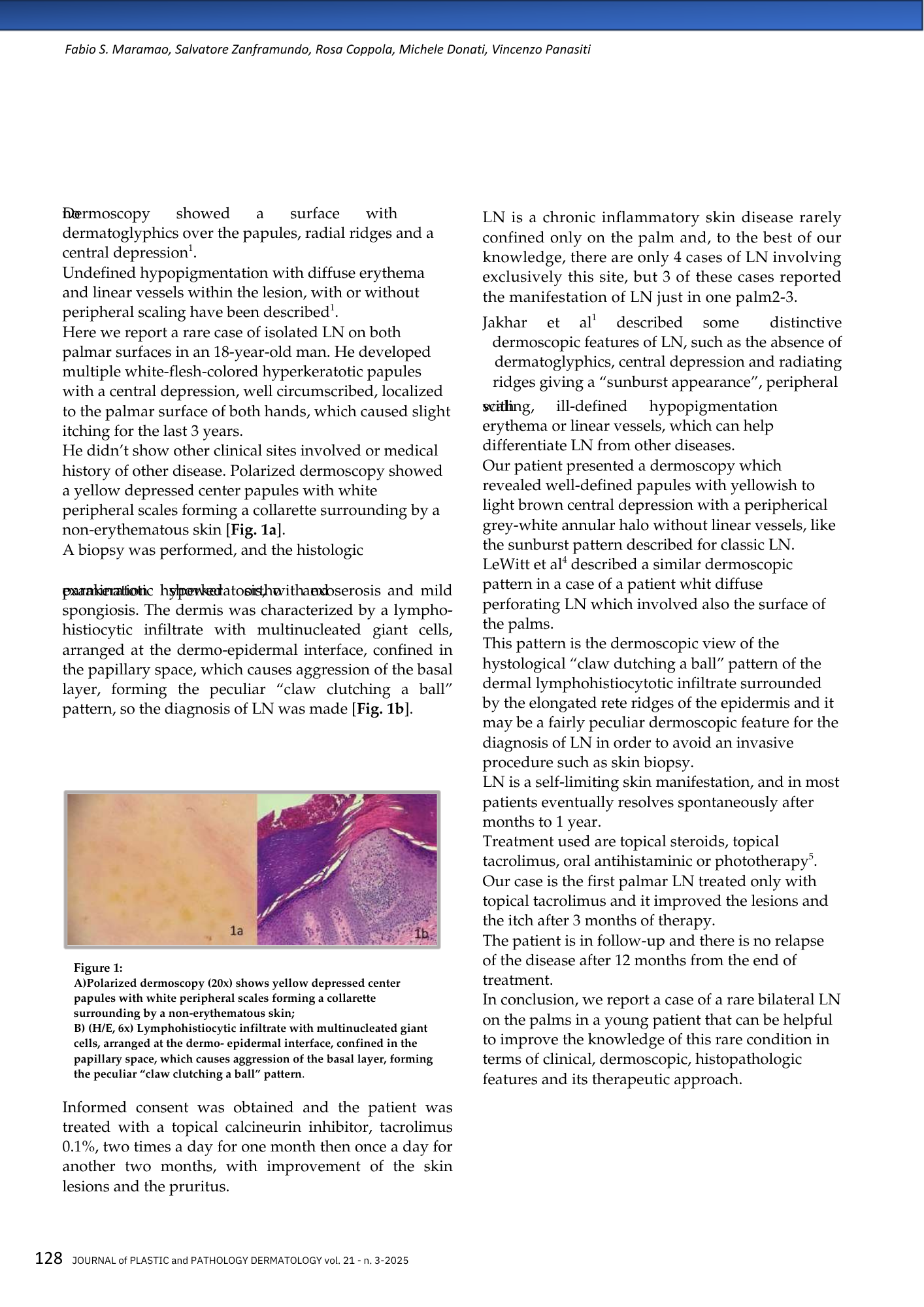 Un documento scientifico con testo e due immagini di un caso clinico di dermoscopia di un paziente con linfoma cutaneo. La prima immagine è una foto a luce polarizzata di un'area cutanea con una depressione centrale giallastra. La seconda immagine è 