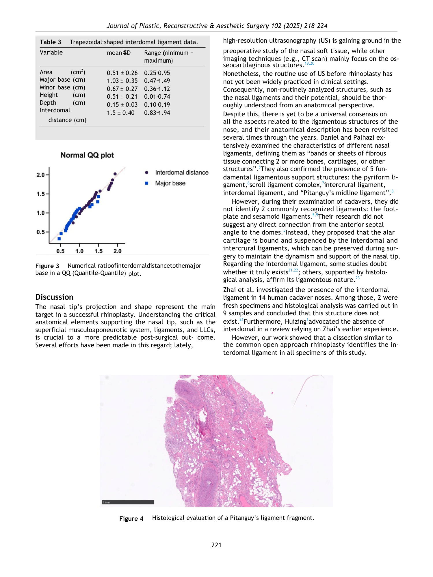 Immagine di un grafico numerico con punti in diversi colori e un diagramma di dispersione tra i valori di distanza interrosse e base maggiore. Sotto, un'immagine istologica di un frammento di legamento di Pitanguy osservato al microscopio, colorato c