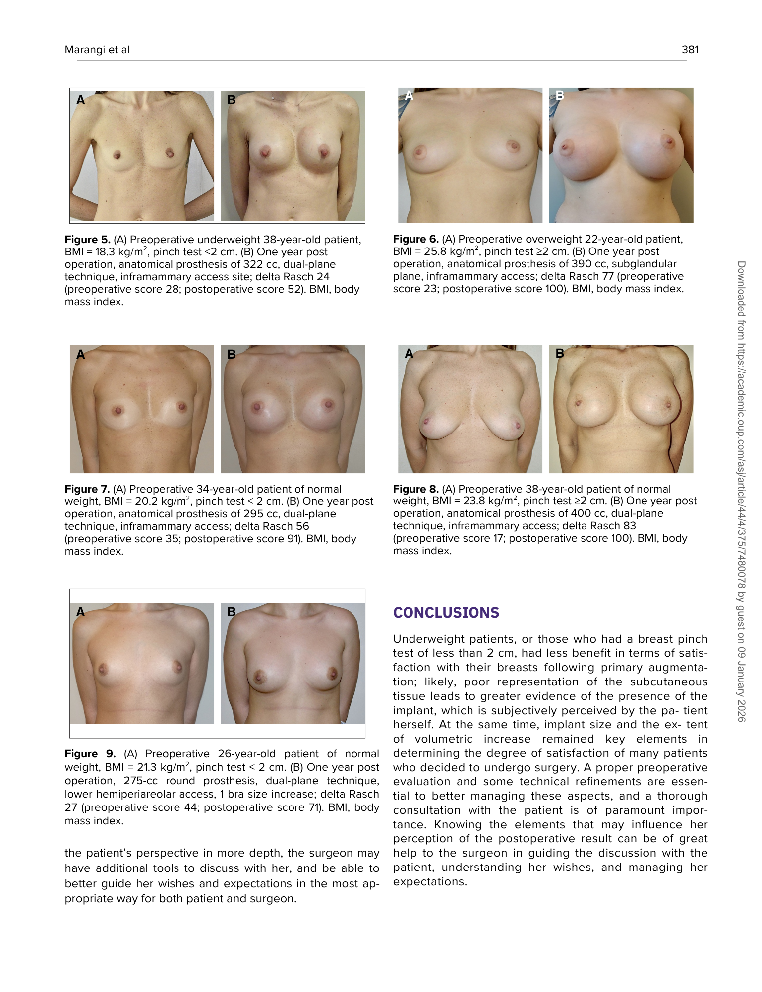 Serie di fotografie di pazienti prima e dopo interventi di mastoplastica con varie condizioni di peso e dimensioni del seno.