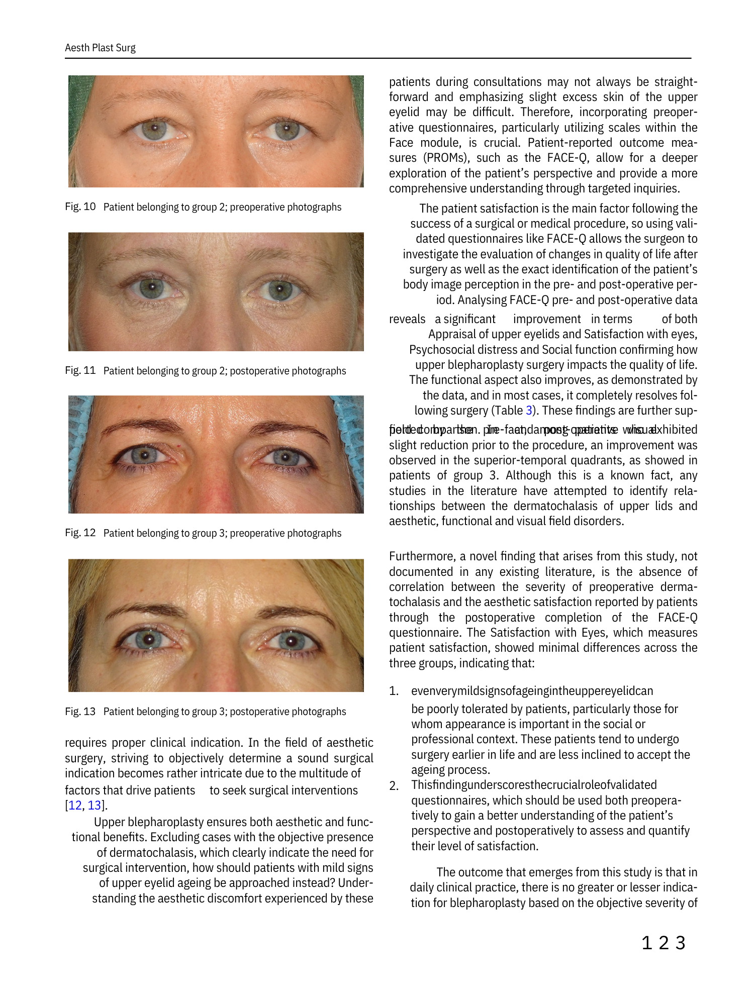 Serie di fotografie di primi e post-operatori di una paziente donna con asportazione di pelle intorno agli occhi, mostrando miglioramenti nel tempo.