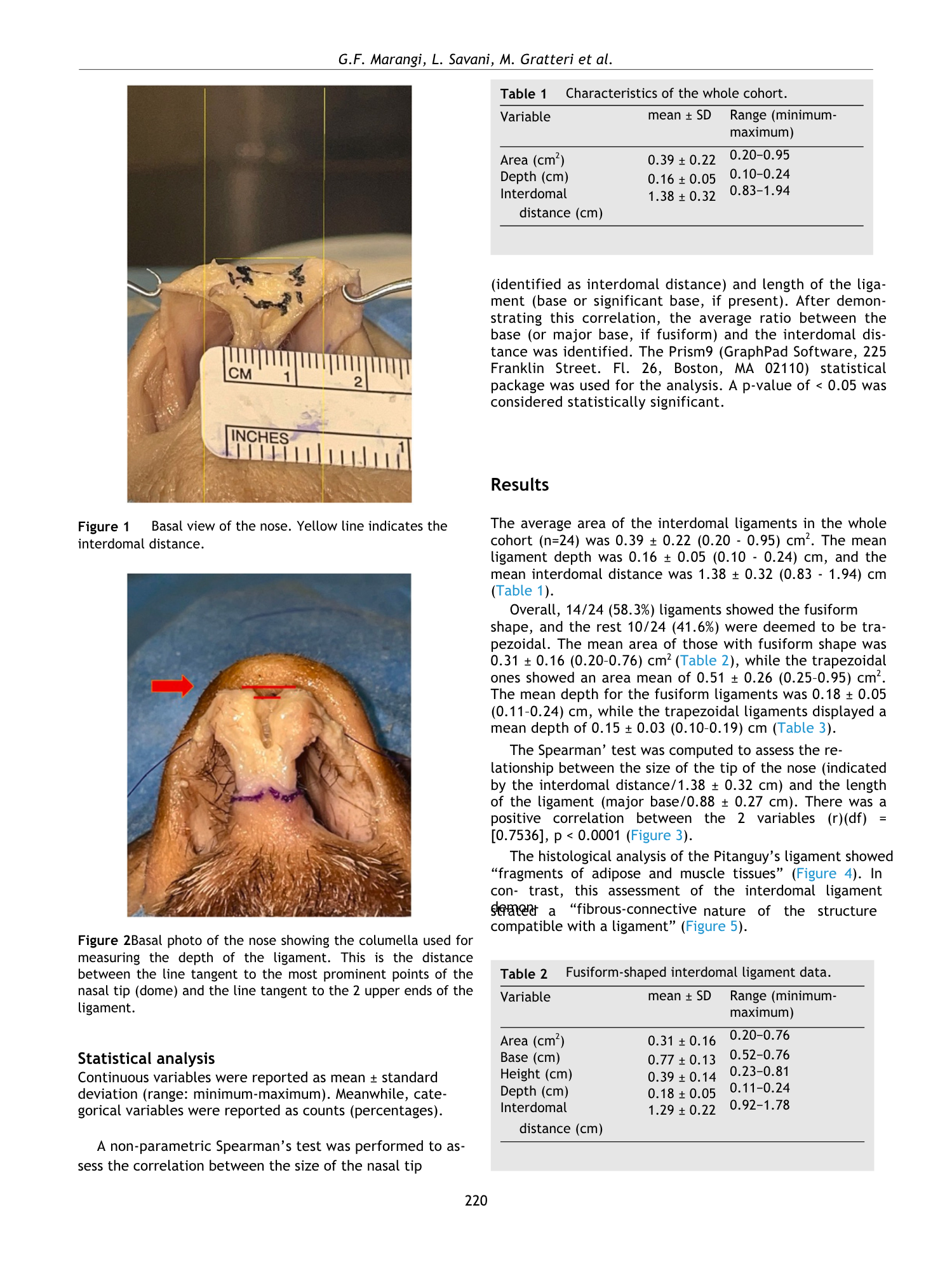 Immagine di una vista basale del naso con linea gialla che indica la distanza interpalpebrale.