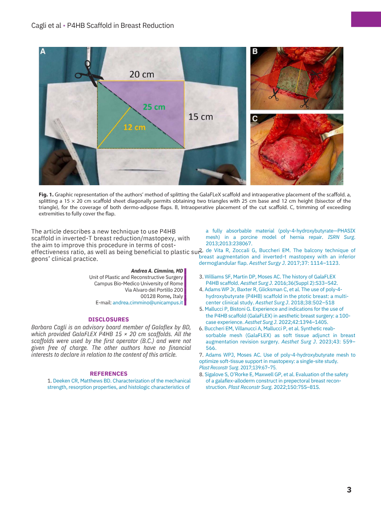 Schema illustrativa di un metodo per suddividere un modello di scaffale di Galaflex utilizzato nelle procedure di riduzione mammaria/inverted-T mastopexy, con immagini di un intervento chirurgico e un modello di diagramma di progettazione.