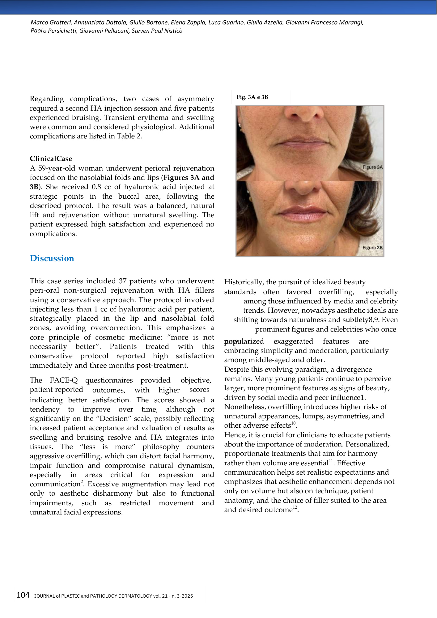 Fotografie di una donna anziana con rughe, mostrando prima (Figura 3A) e dopo (Figura 3B) un trattamento di ringiovanimento periorale e labiale, con evidenti miglioramenti nel sorriso e nelle pieghe nasolabiali.