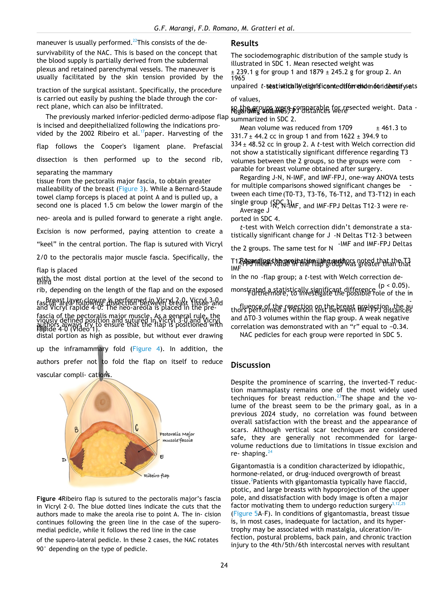 Diagramma illustrante la flap di Ribeiro, sormontata alla fascia del grande muscolo pettorale, con linee di taglio indicating i punti di incisione e i lembi di tessuto.